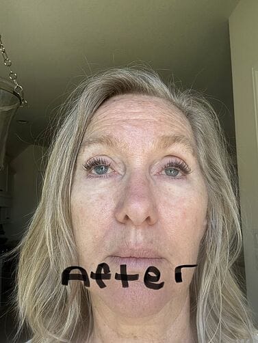 Customer photo review of Perfect Instant Face Tightener