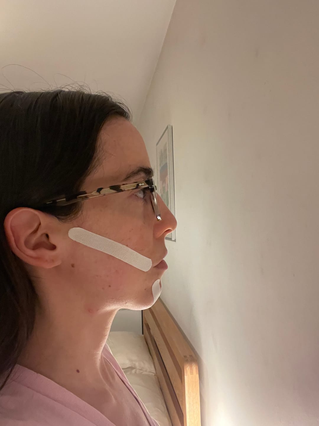 Customer photo review of Zygo Tape - Facial Sculpting & Anti-Aging Tape