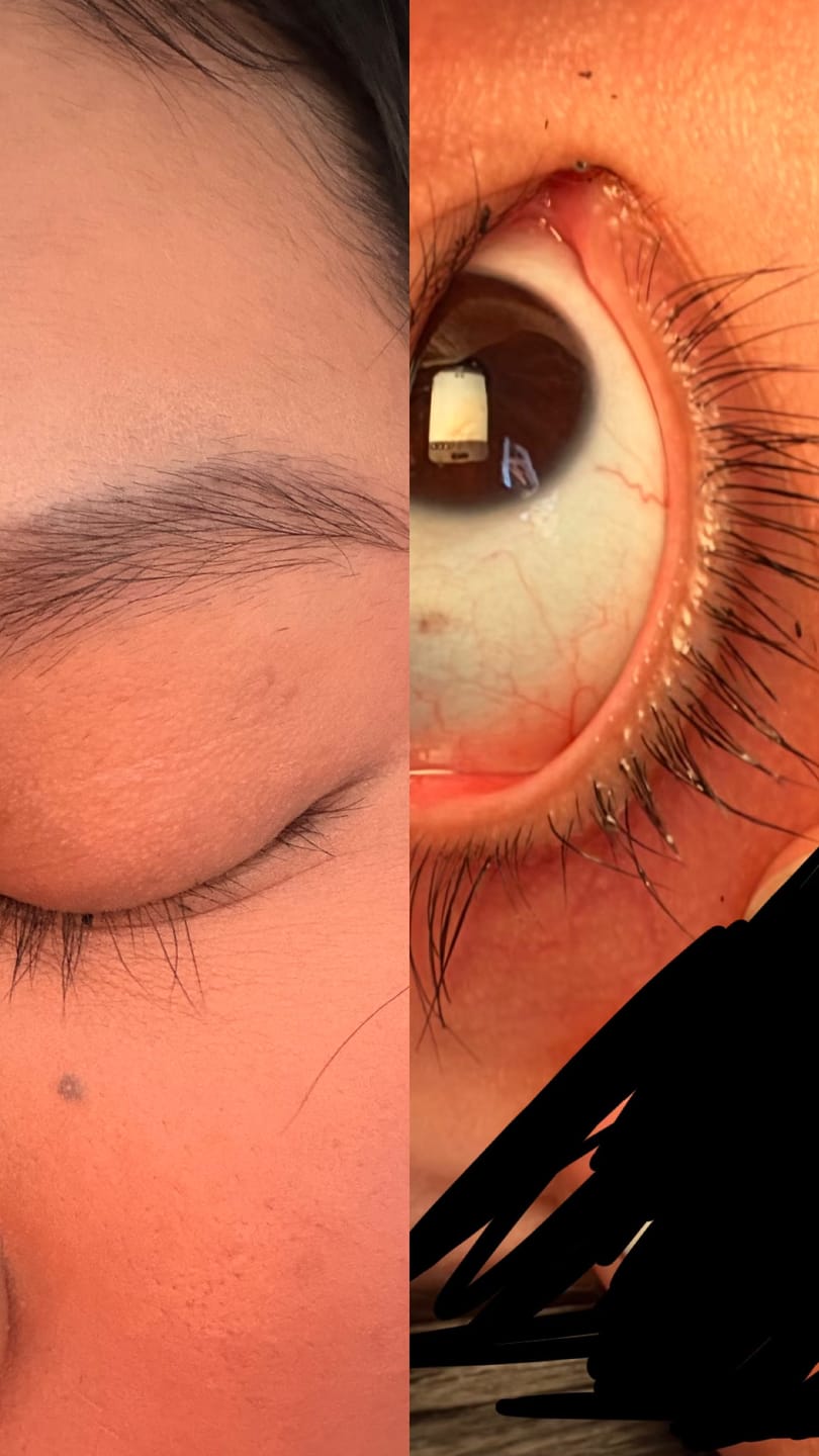 Customer photo review of fLASH EYELASH SERUM