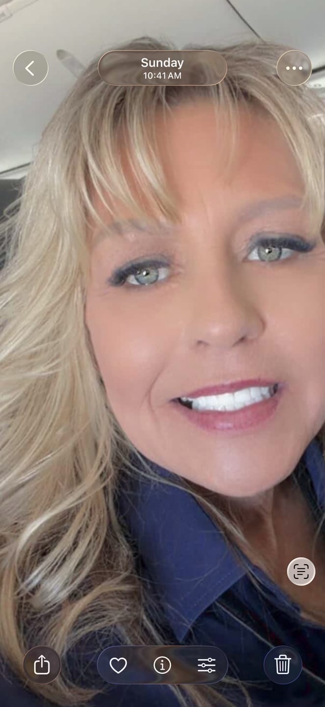 Customer photo review of Lanera Luxury Foundation