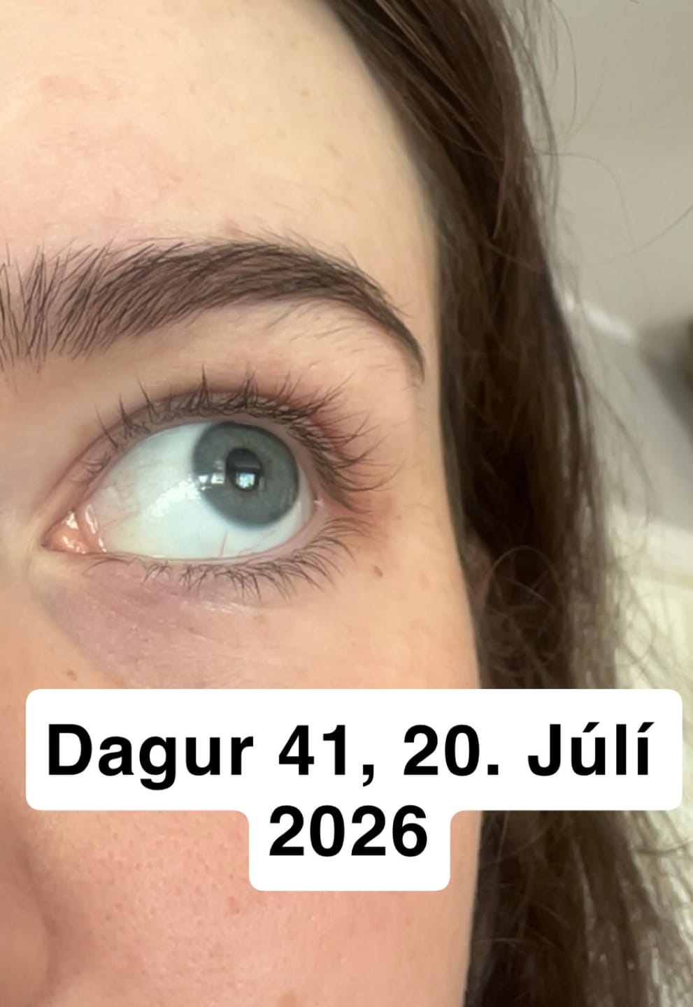 Customer photo review of Lash Serum | INTENSE