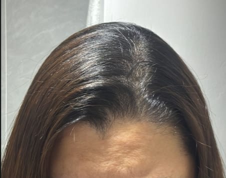 Customer photo review of KIT LISO PERFECTO 20% DESCUENTO