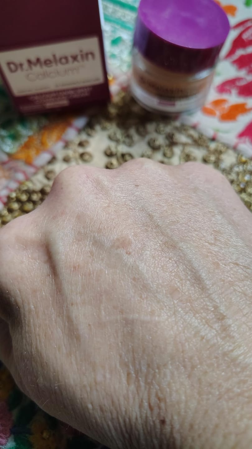 Customer photo review of Ecleria Calcium Eye Cream