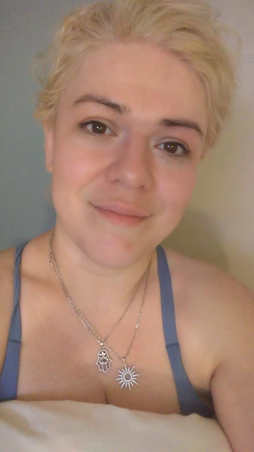Customer photo review of Ecleria Calcium Eye Cream