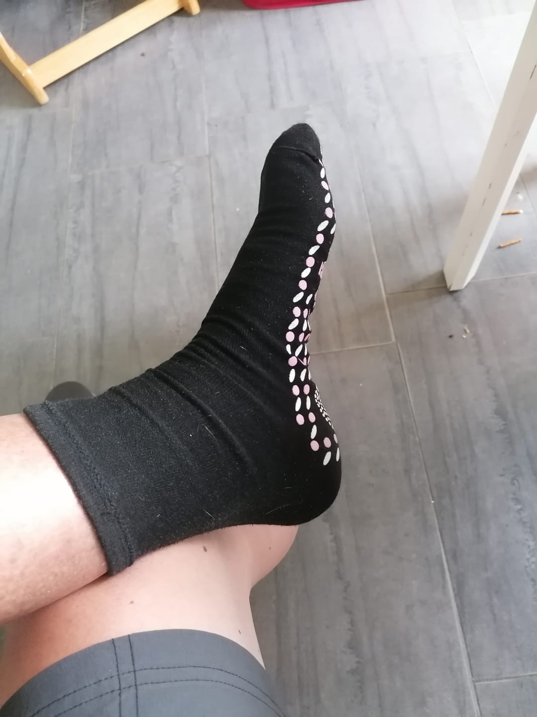 Customer photo review of Vitalkompass – Neurosocken (Neuropathie Sommer Socken)