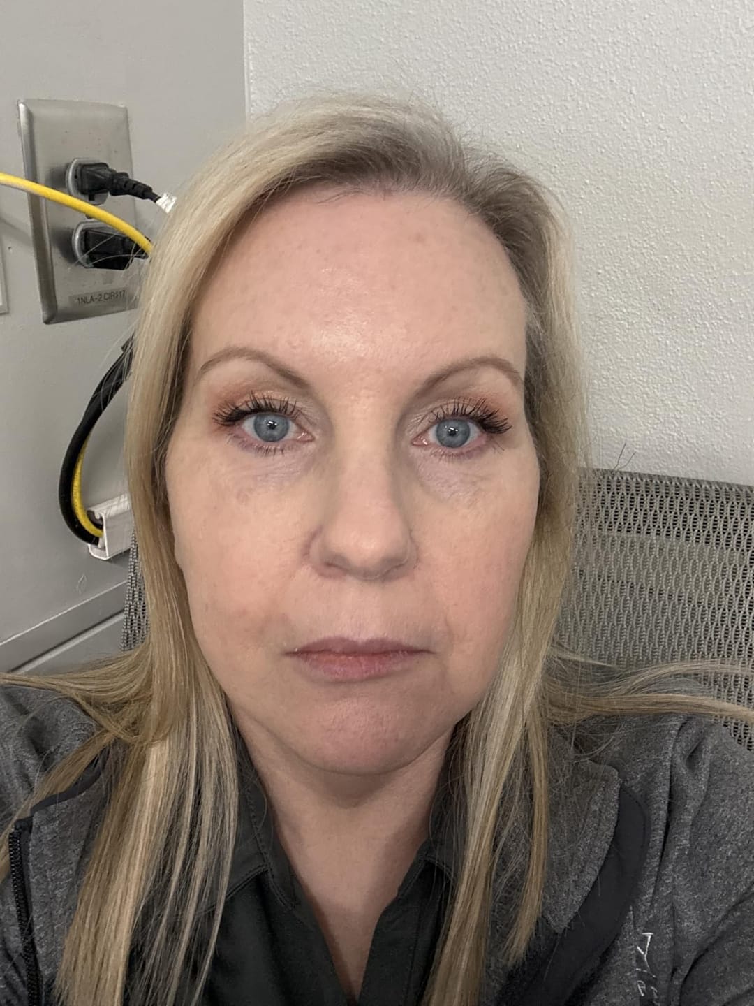 Customer photo review of Ecleria Calcium Eye Cream