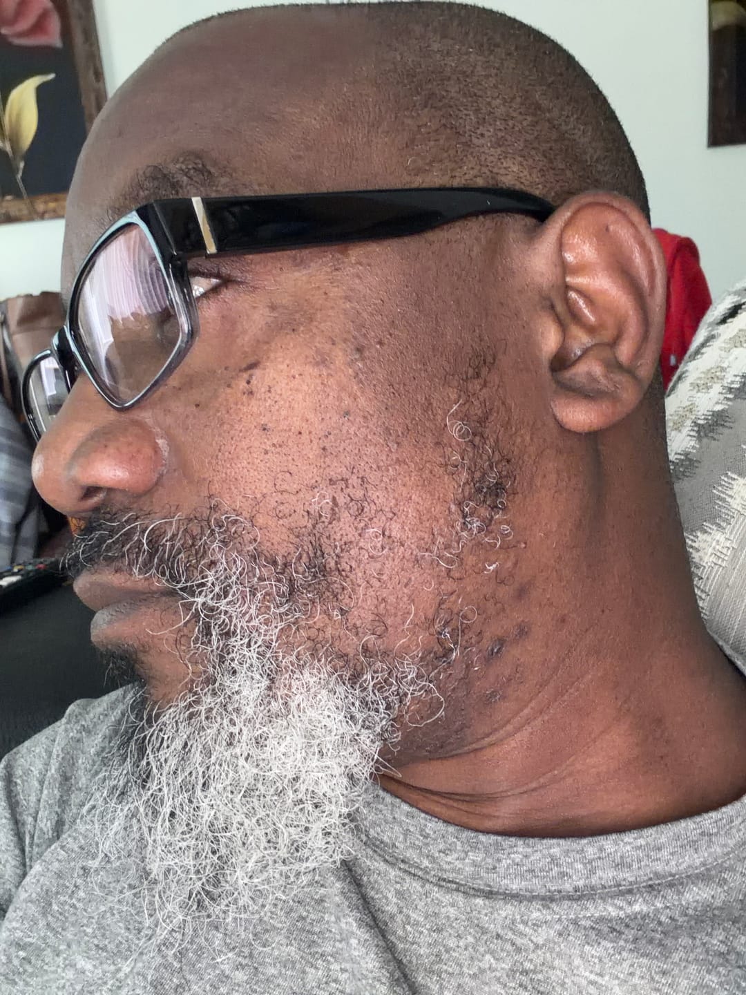 Customer photo review of Beard Care Kit