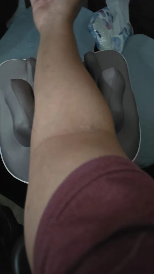 Customer photo review of SpineNeck Knead – Deep Kneading Neck & Shoulder Massager