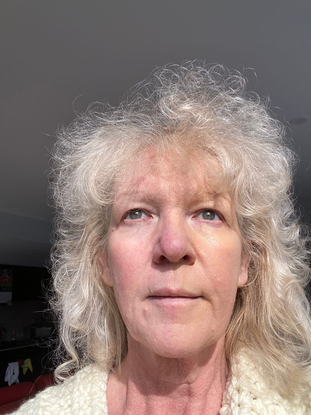 Customer photo review of Tinted Sheer Zinc Oxide Cream