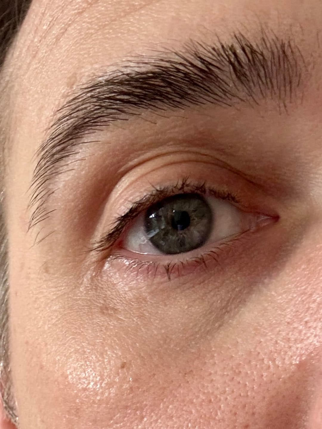 Customer photo review of Ecleria Calcium Eye Cream