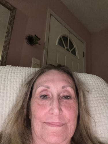 Reviewer's close-up photo of their face showing a glow after using Koriderm™ Time Reverse Cream.