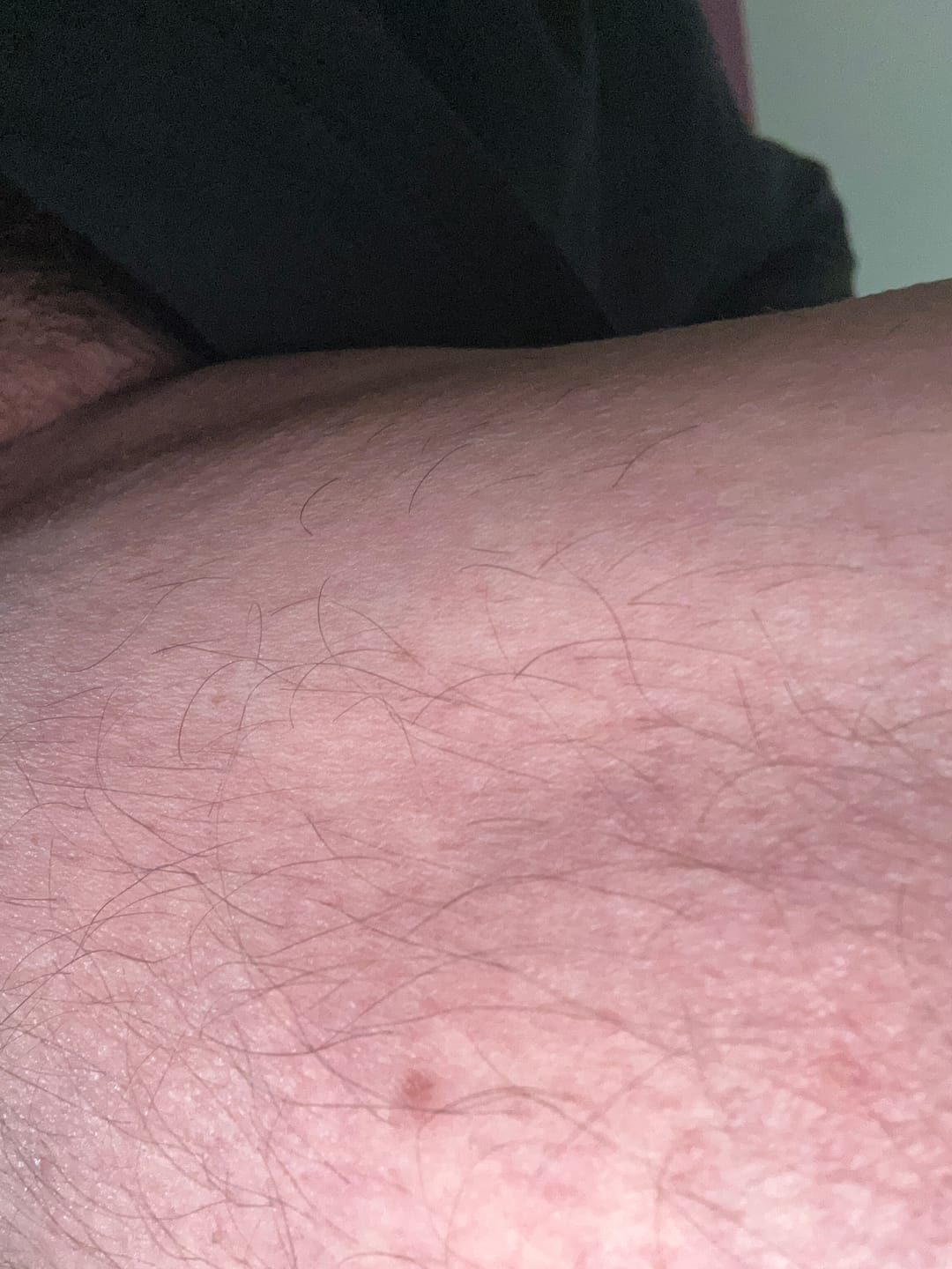Customer photo review of Bumzzy Butt Shaver 2.0