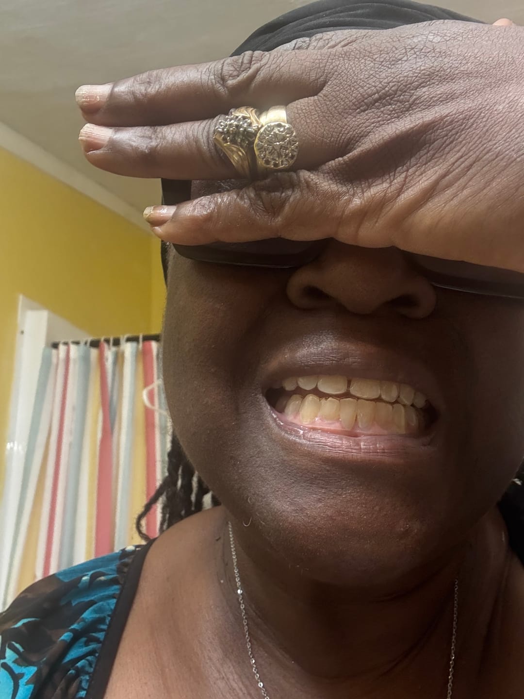 Customer photo review of Upper and Lower Retainers Set