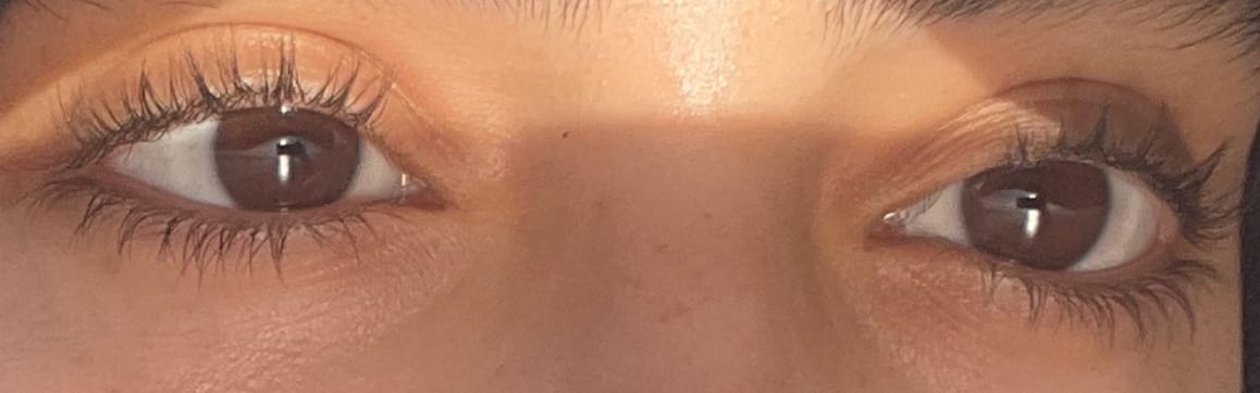 Customer photo review of LASH GROWTH SERUM