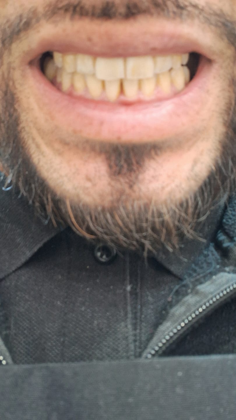 Customer photo review of Abrillantador Pro
