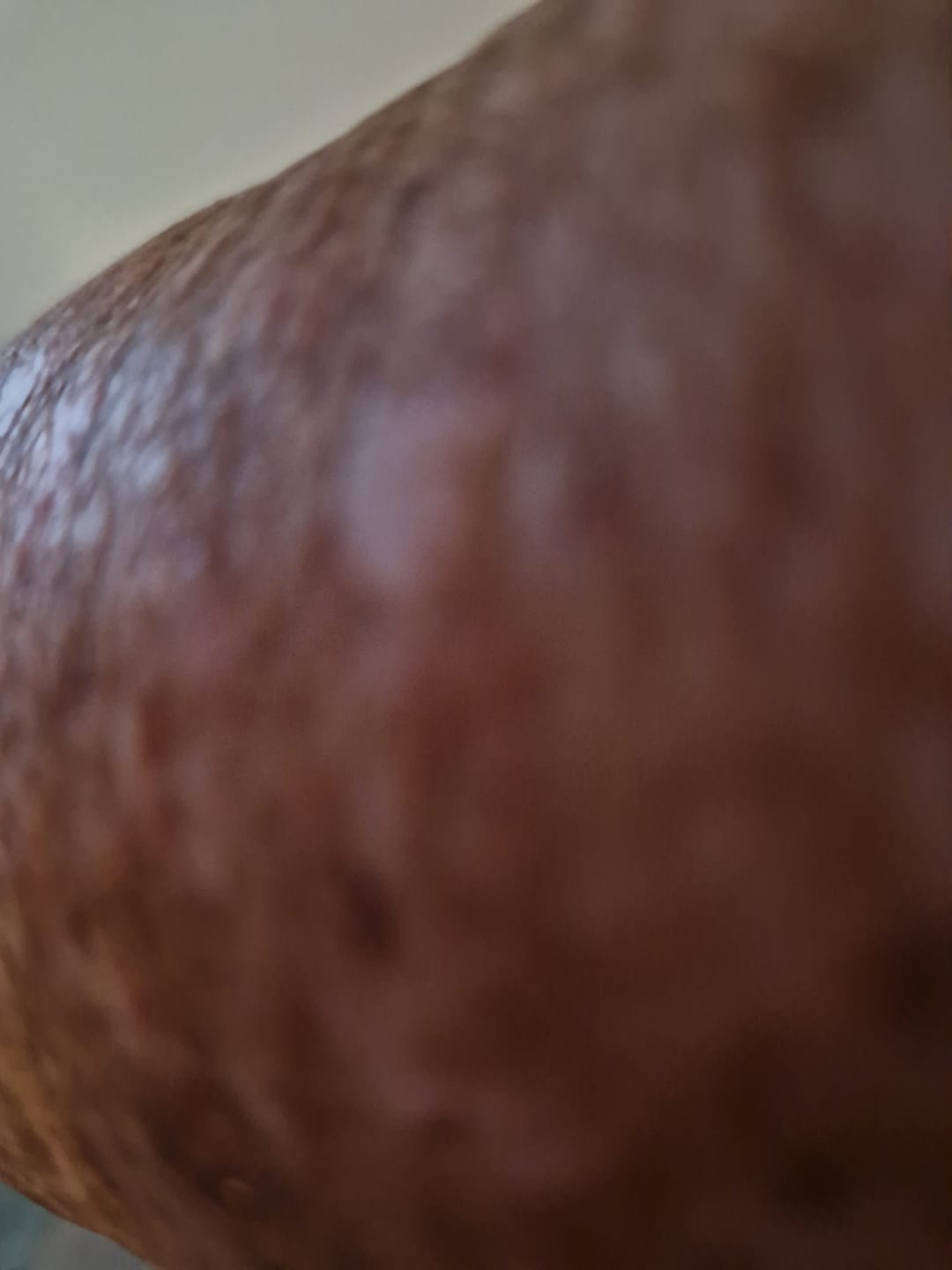 Customer photo review of Bioskin Junior Daily Face Moisturiser