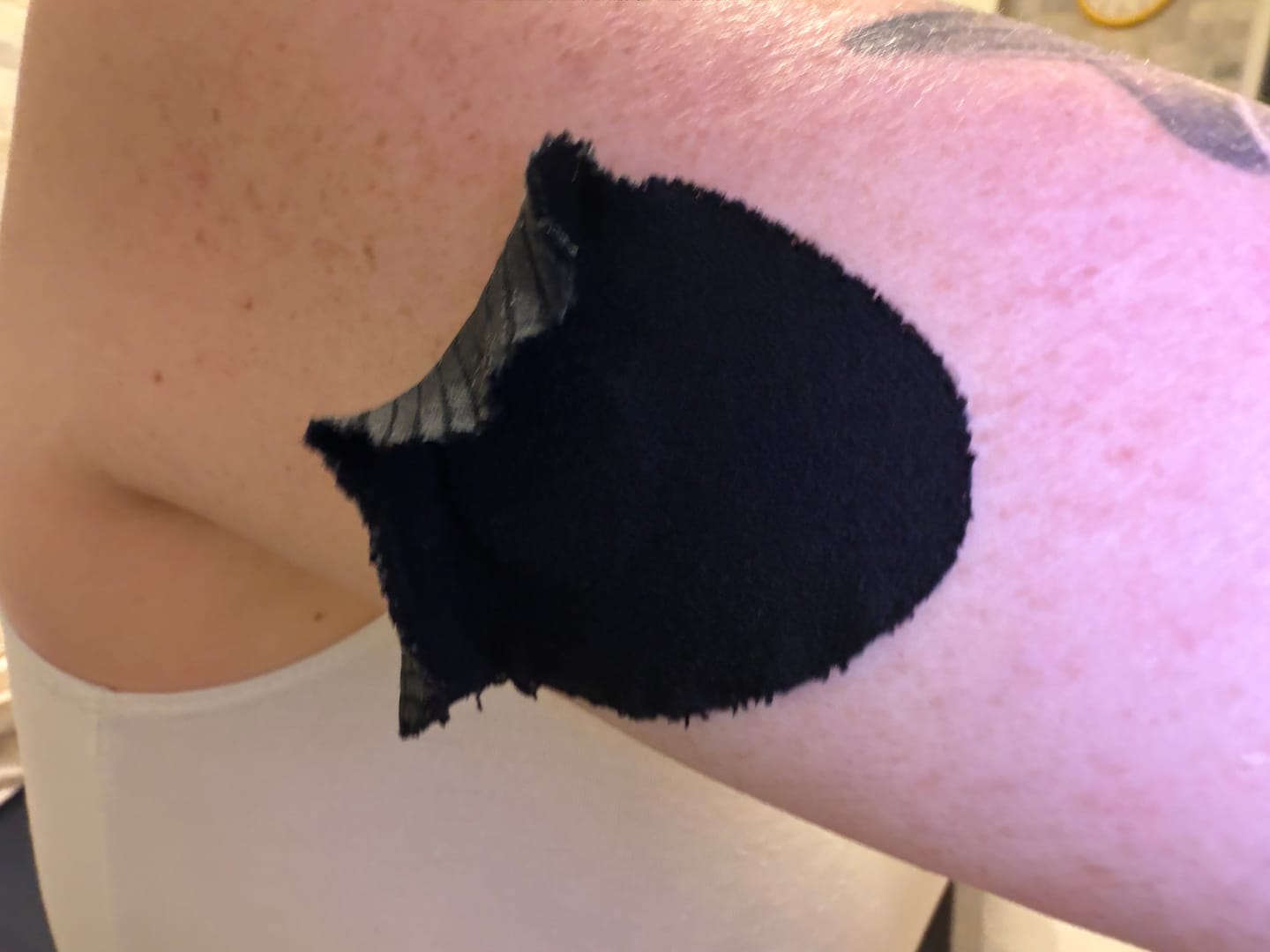 Customer photo review of Original Patch תפזורת 20 יח׳