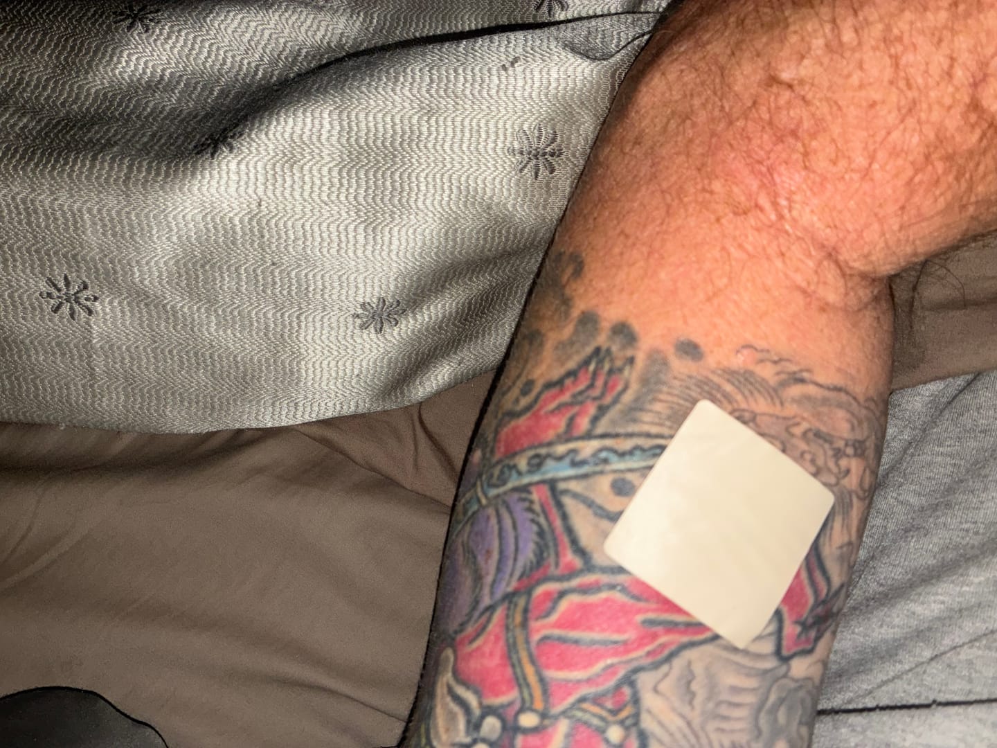 Customer photo review of mussage 8 Hour Sleep Patch