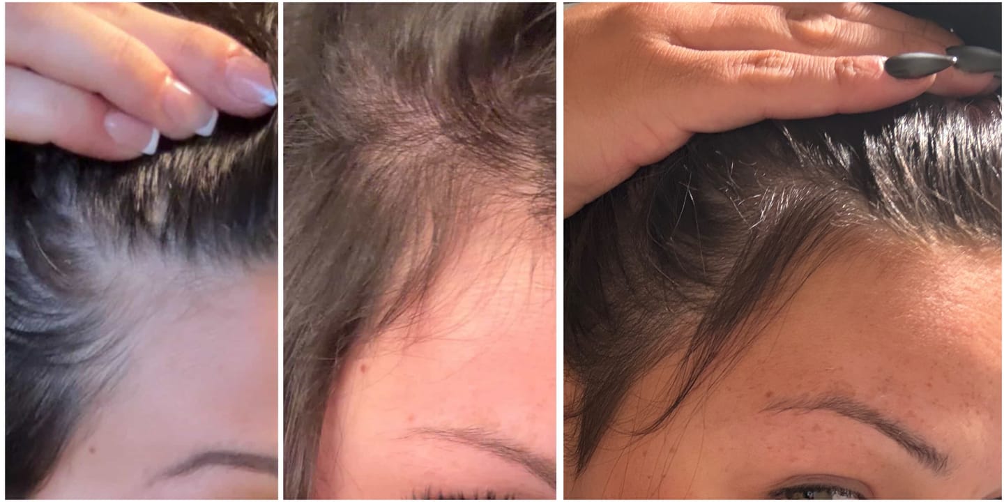 Customer photo review of Pre-Wash Scalp fortifying oil - Rosemary