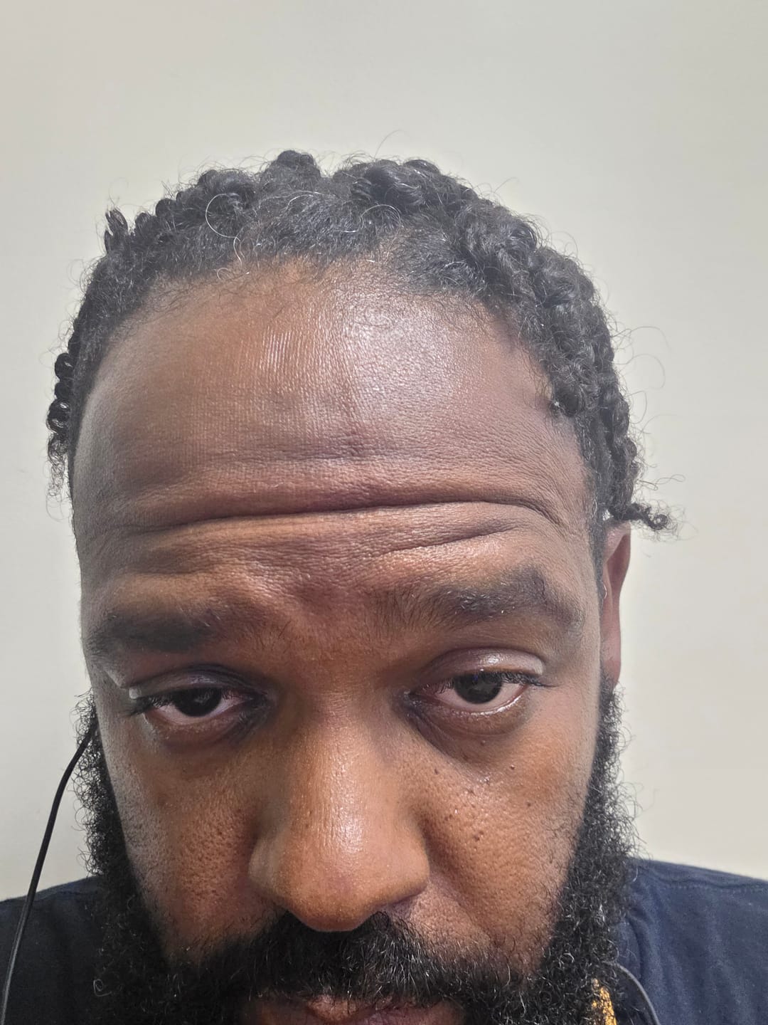 Customer photo review of Spartan™ Root Activator Shampoo 3 Bottles(sc)
