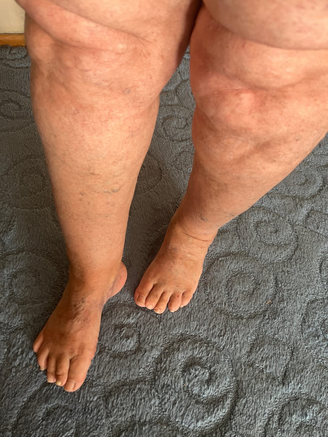 Customer photo review of NuSoothe® Closed-Toe High Waisted Compression Tights