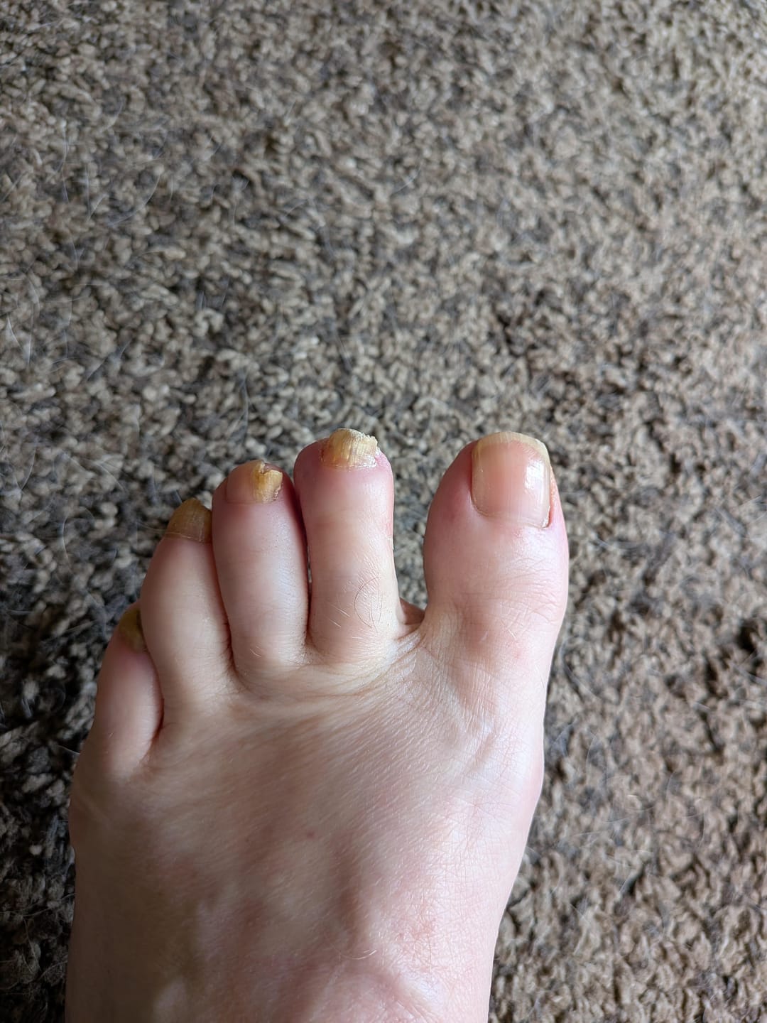 Customer photo review of Fungal Freedom