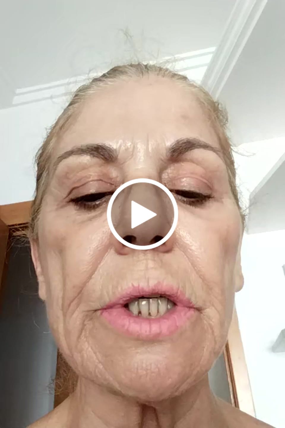 Customer video review of Serum Ultra Rejuvenecedor EXO-PDRN