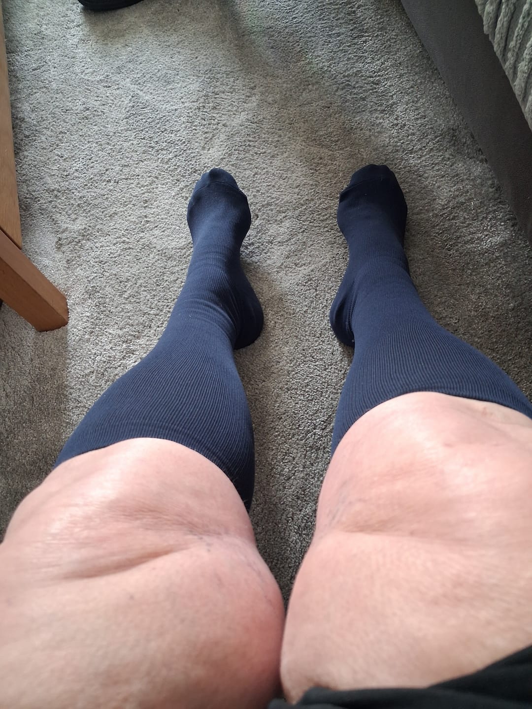 Customer photo review of EverSock™ Wide Compression Socks For Pain Relief