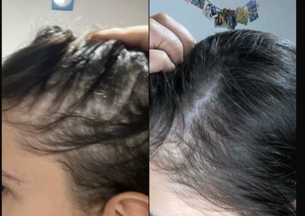 Customer photo review of Tónico Capilar de Romero  · Crecimiento y Anticaída