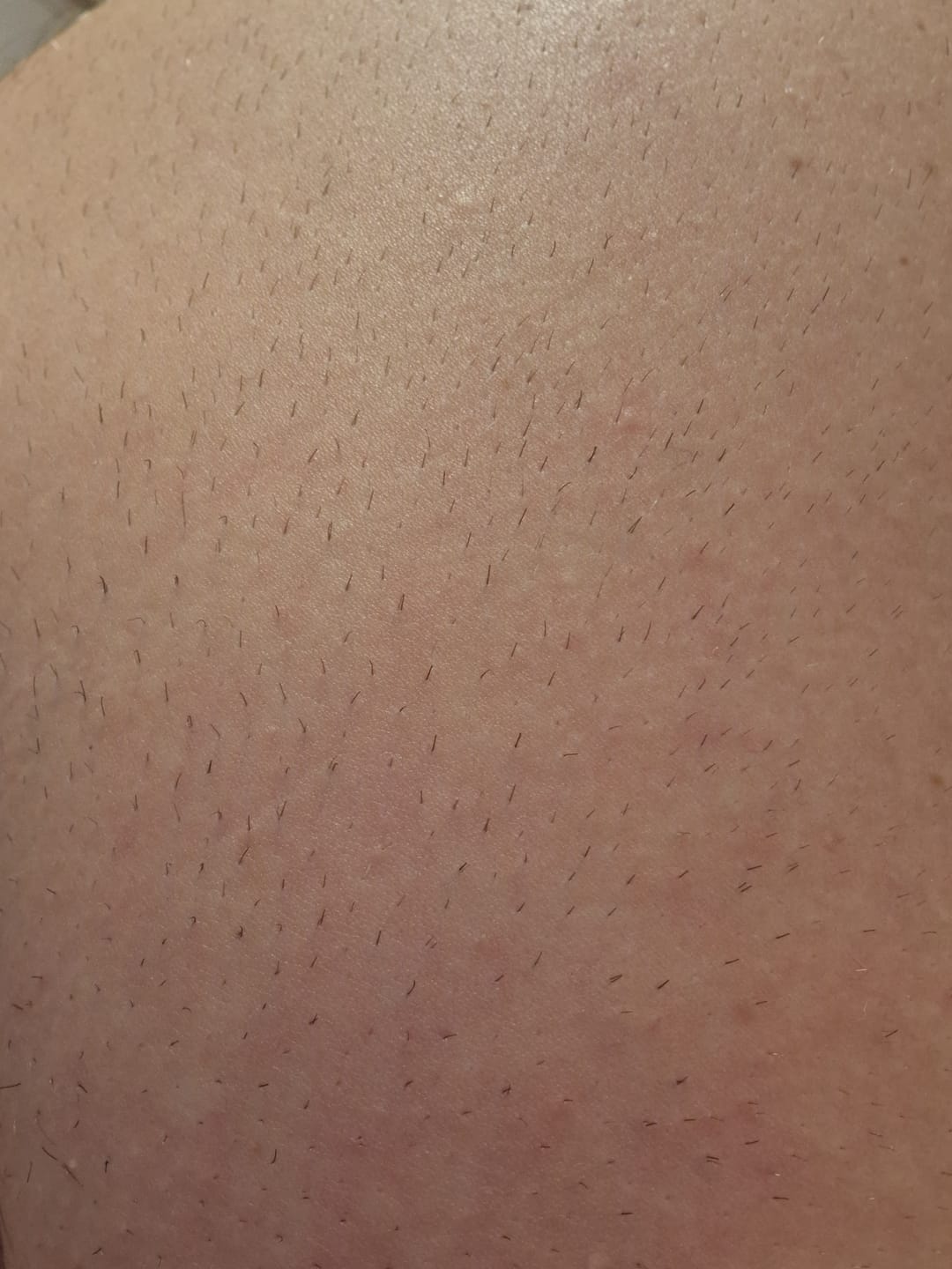 Customer photo review of Premium Haarfrei Bundle
