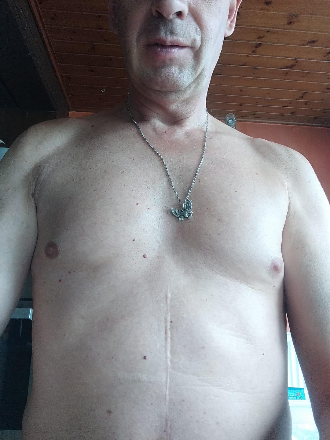 Customer photo review of 2x Belle Body Hair Removal