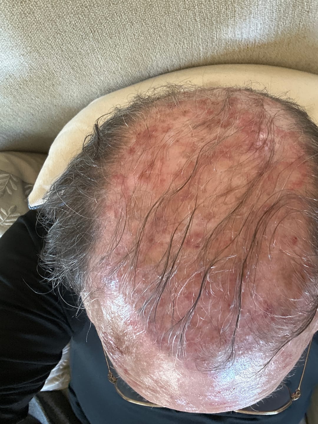 Customer photo review of SPARTAN™ - Root Activator Spray