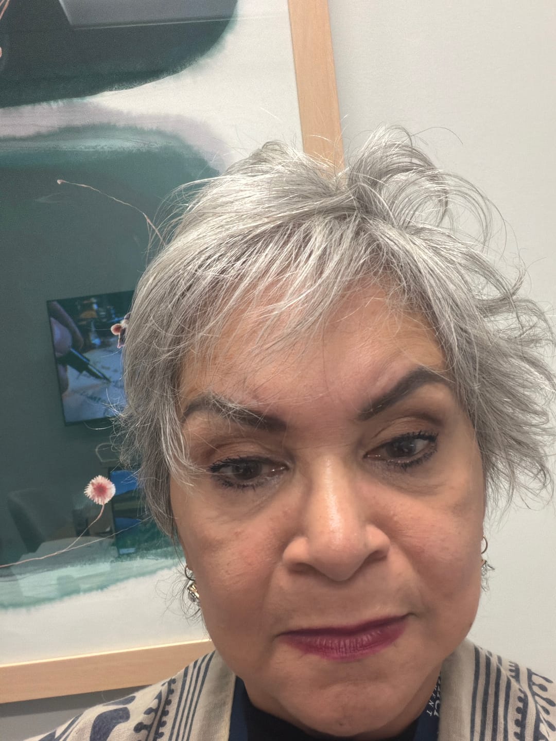 Customer photo review of 1 Month Supply - Micro Infusion Patches
