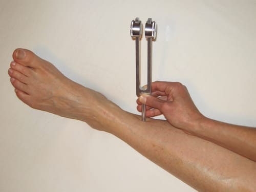 Customer photo review of Diapason Thérapeutique 128Hz