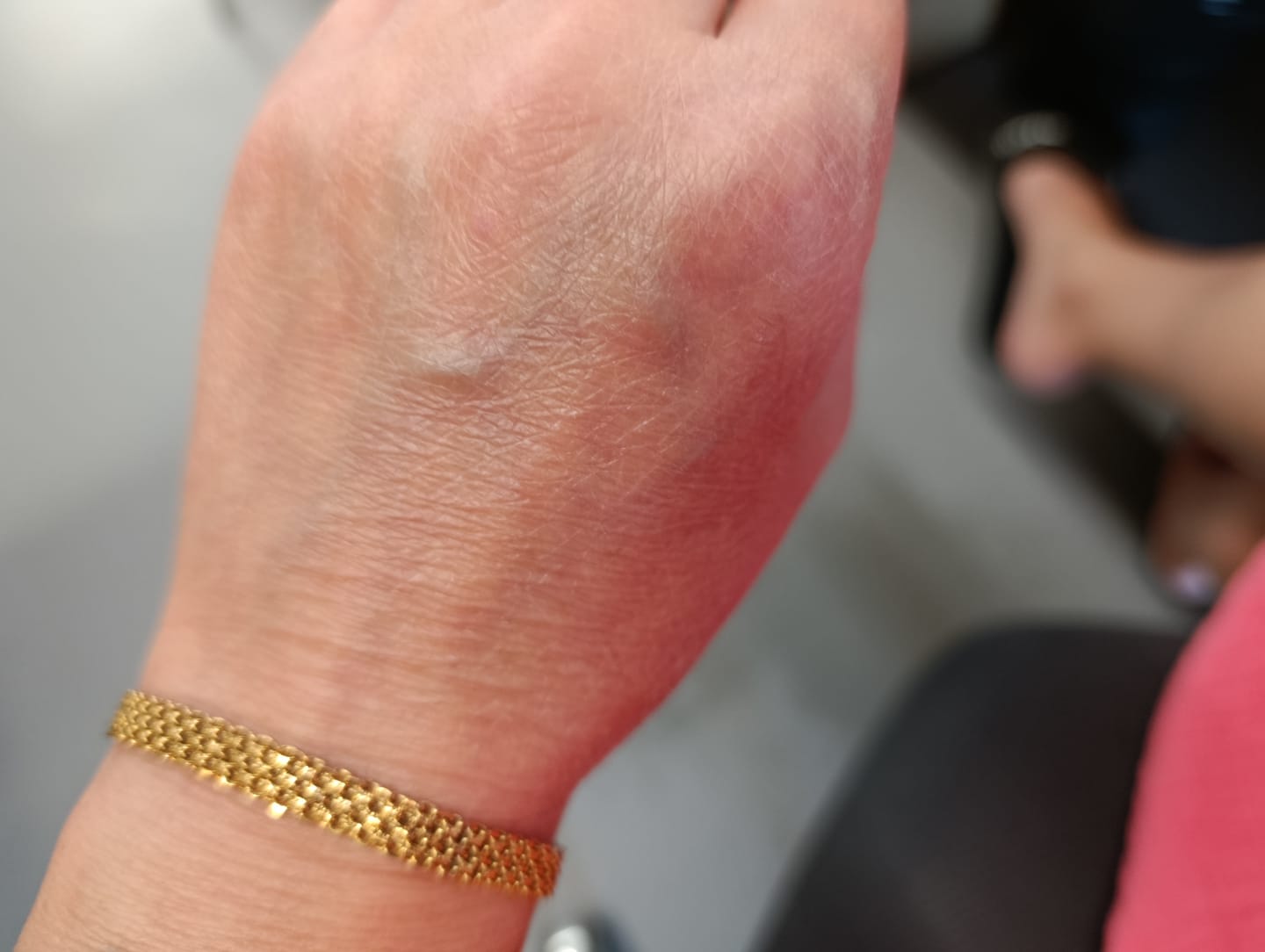 Customer photo review of Bracelet: Zara