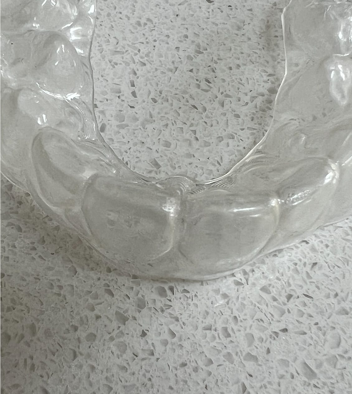 Customer photo review of Essix Retainers