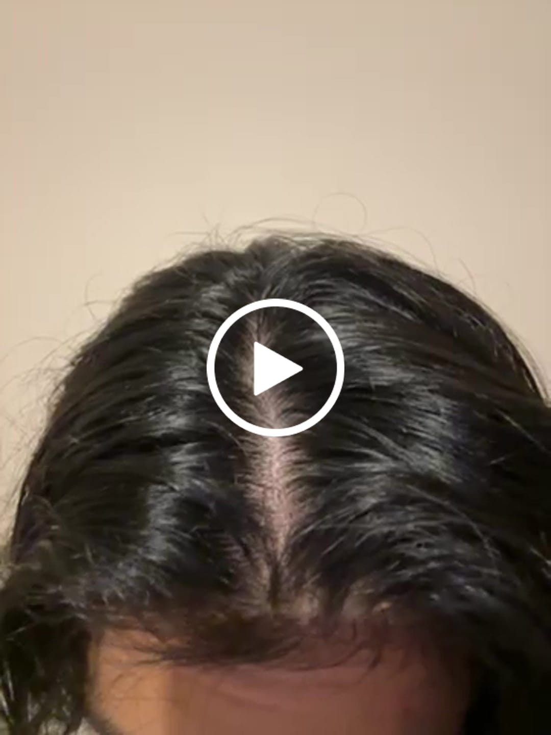 Customer video review of Pack Anticaspa Seca o Psoriasis Básico Líquido