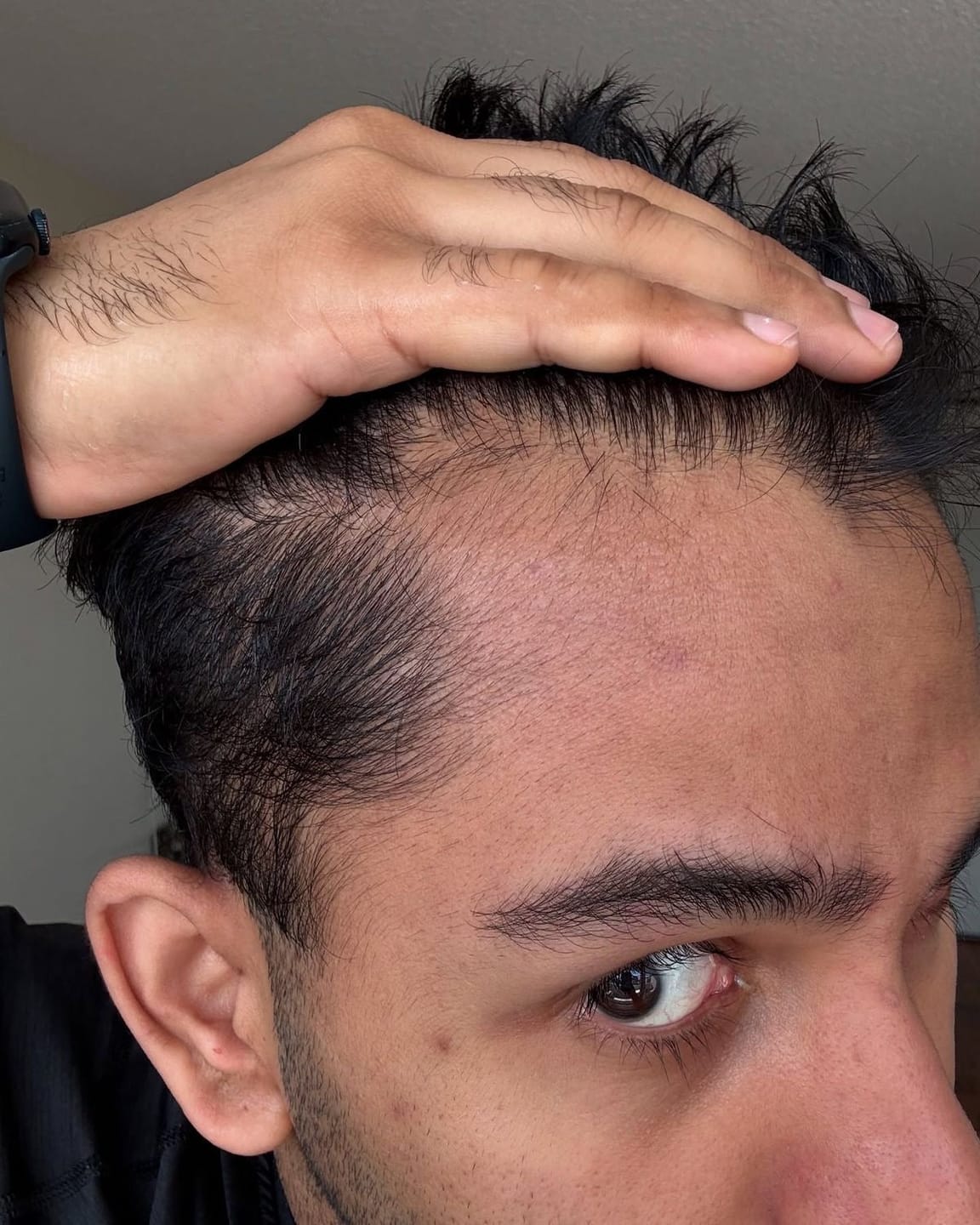 Customer photo review of Grau-Abdeck Farbshampoo