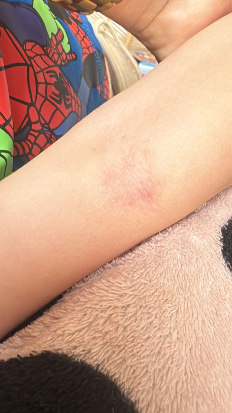 Customer photo review of Grass-Fed Tallow Soap | Moisturising Cleansing Bar