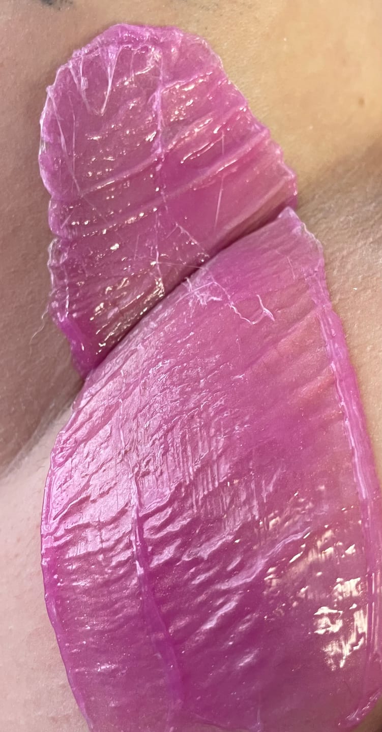 Customer photo review of Signature Series Hair Removal Wax