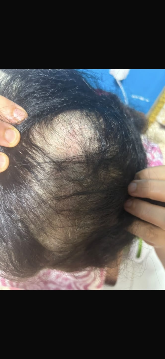 Customer photo review of Pack Anti Chute Touché