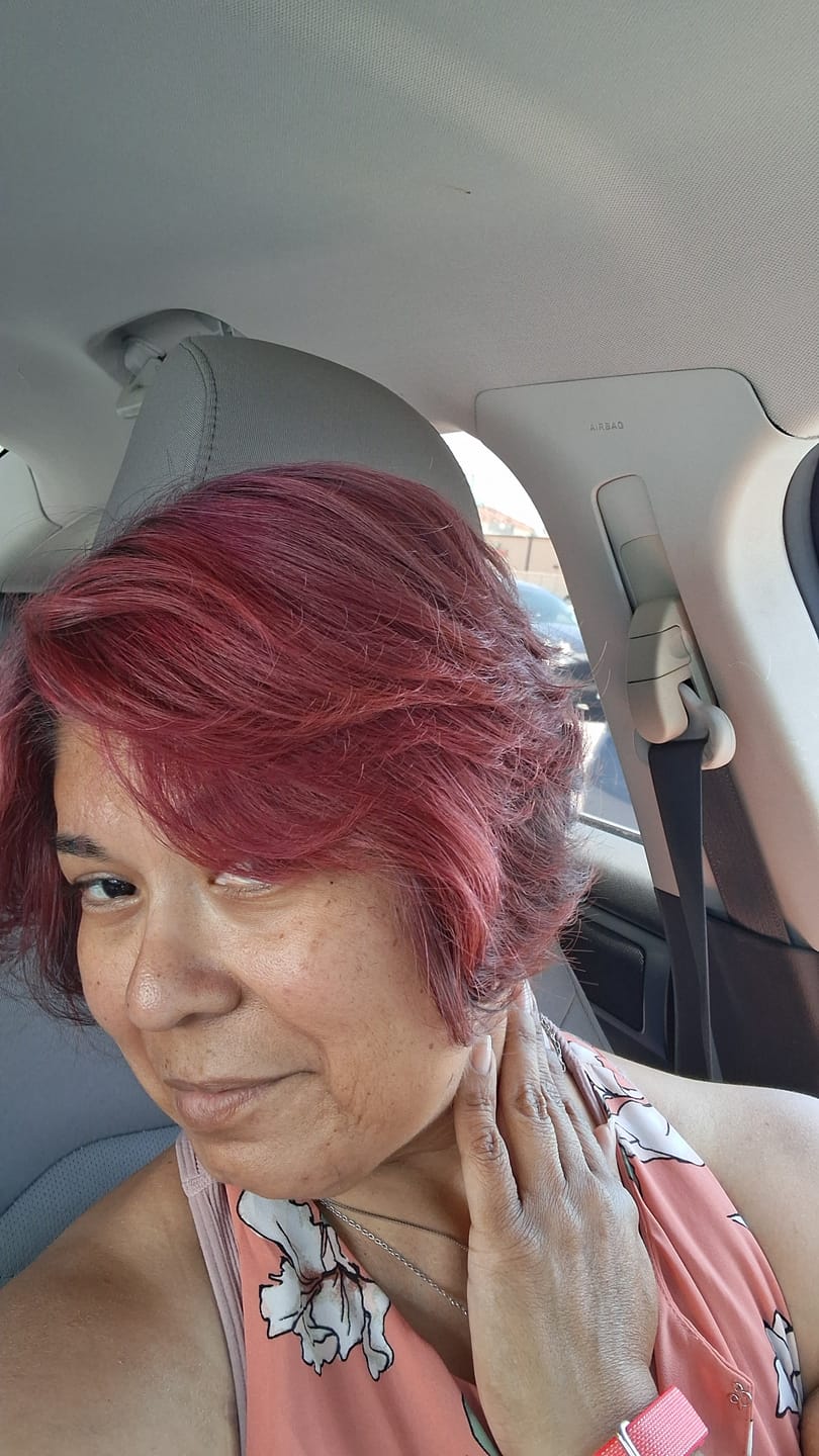 Customer photo review of Chemo Skin Care Kit