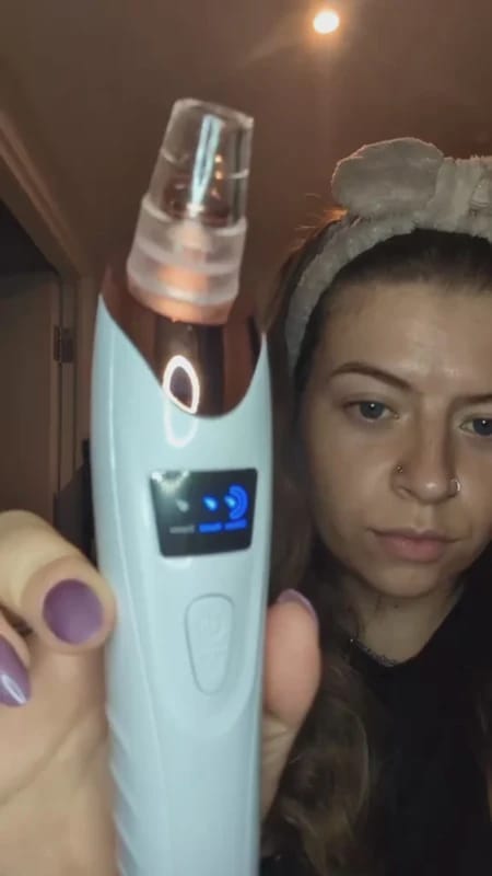 Customer photo review of הערכה המלאה של SkinLight