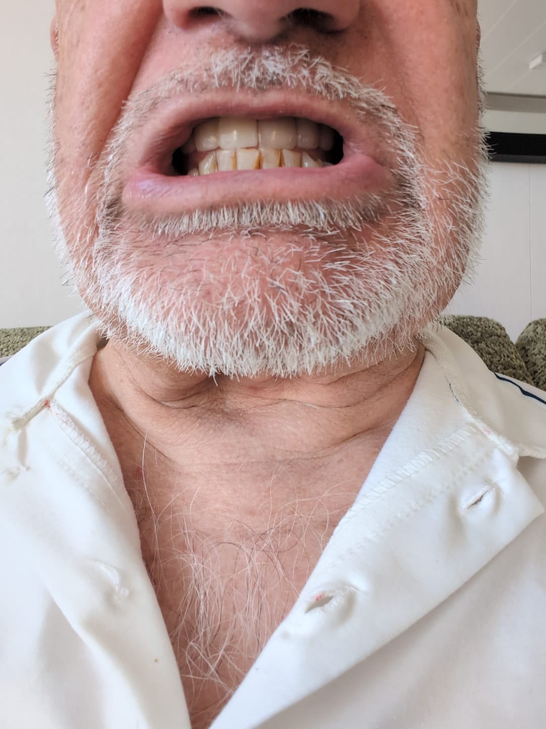 Customer photo review of Teeth Whitening Powder