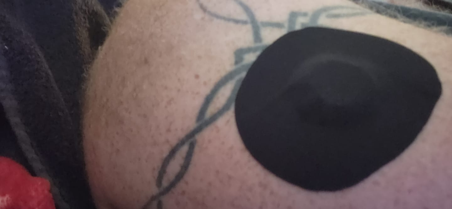 Customer photo review of Skin Grip Original - Dexcom G7 & Stelo Adhesive Patches