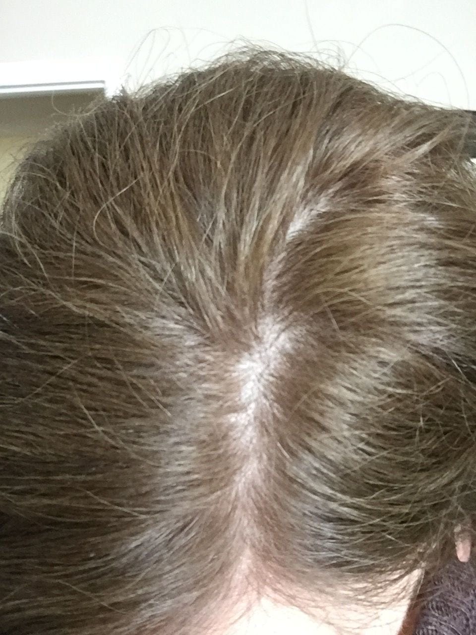 Customer photo review of Grau-Abdeck Farbshampoo