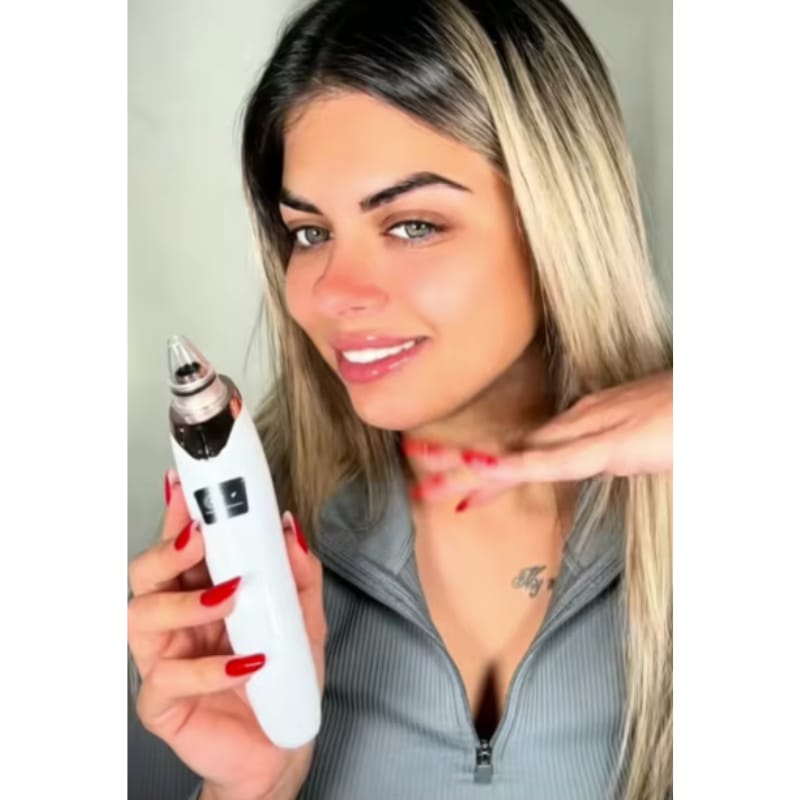 Customer photo review of מכשיר להסרת שחורים של SkinLight
