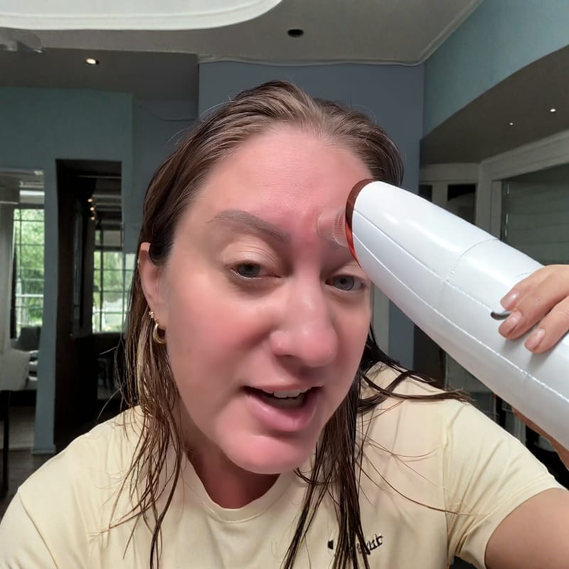 Customer photo review of הערכה המלאה של SkinLight