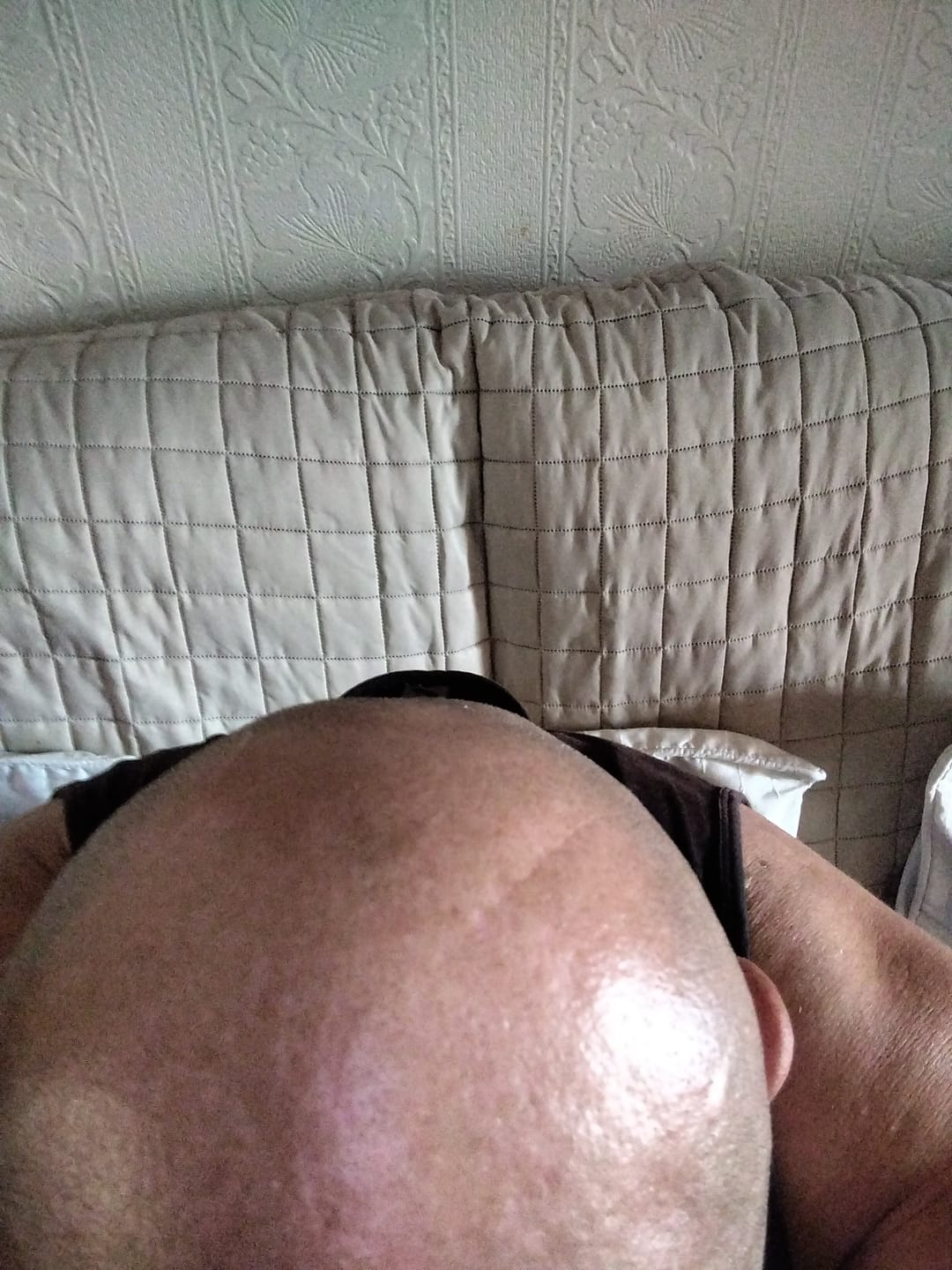 Customer photo review of SmoothShave™ Magnetic Blade refill