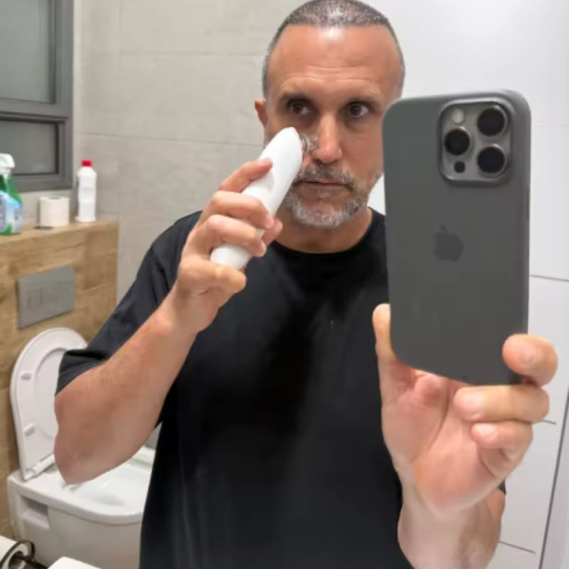 Customer photo review of מכשיר להסרת שחורים של SkinLight